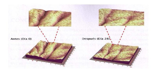 Lifting needle-free mesotherapy ampoules for the face VIRTUAL MES AMPOULES 6x5ml